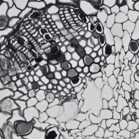 Cellules Dendritiques